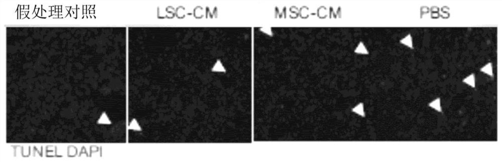 Therapeutic lung repair by inhalation of lung spheroid cell-secreted factors