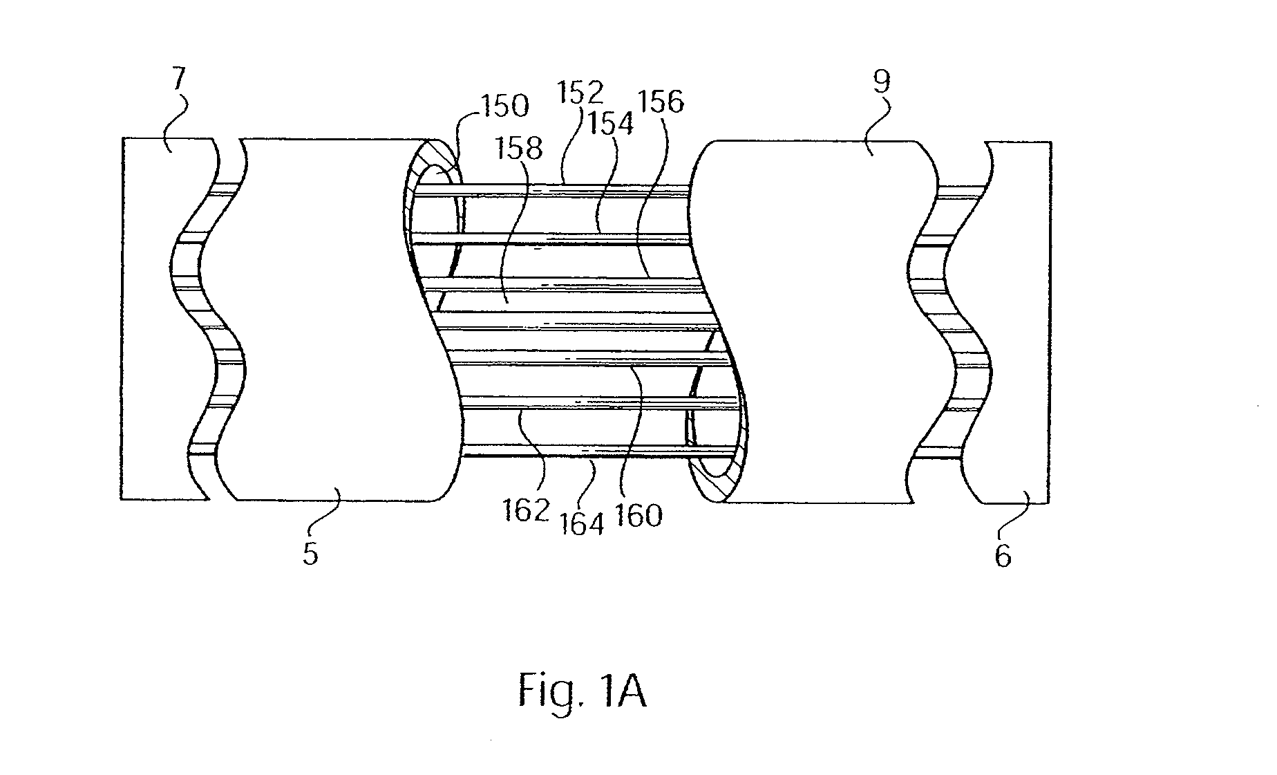 Trocar device