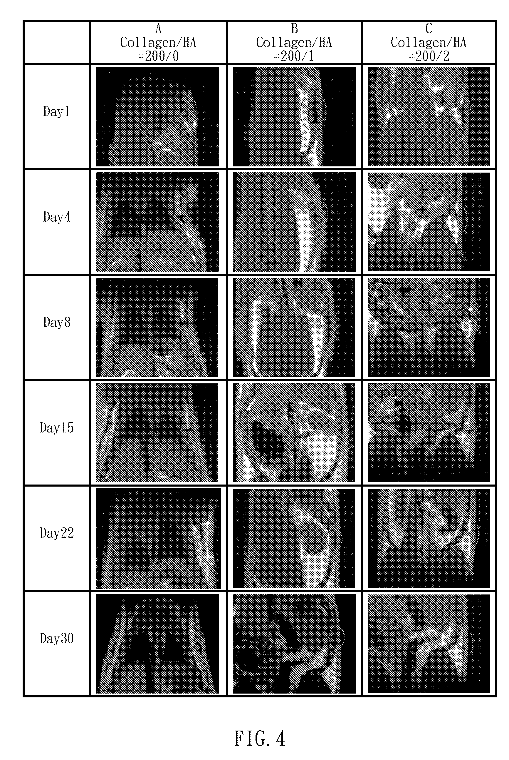 Gel Scaffolds for Tissue Engineering