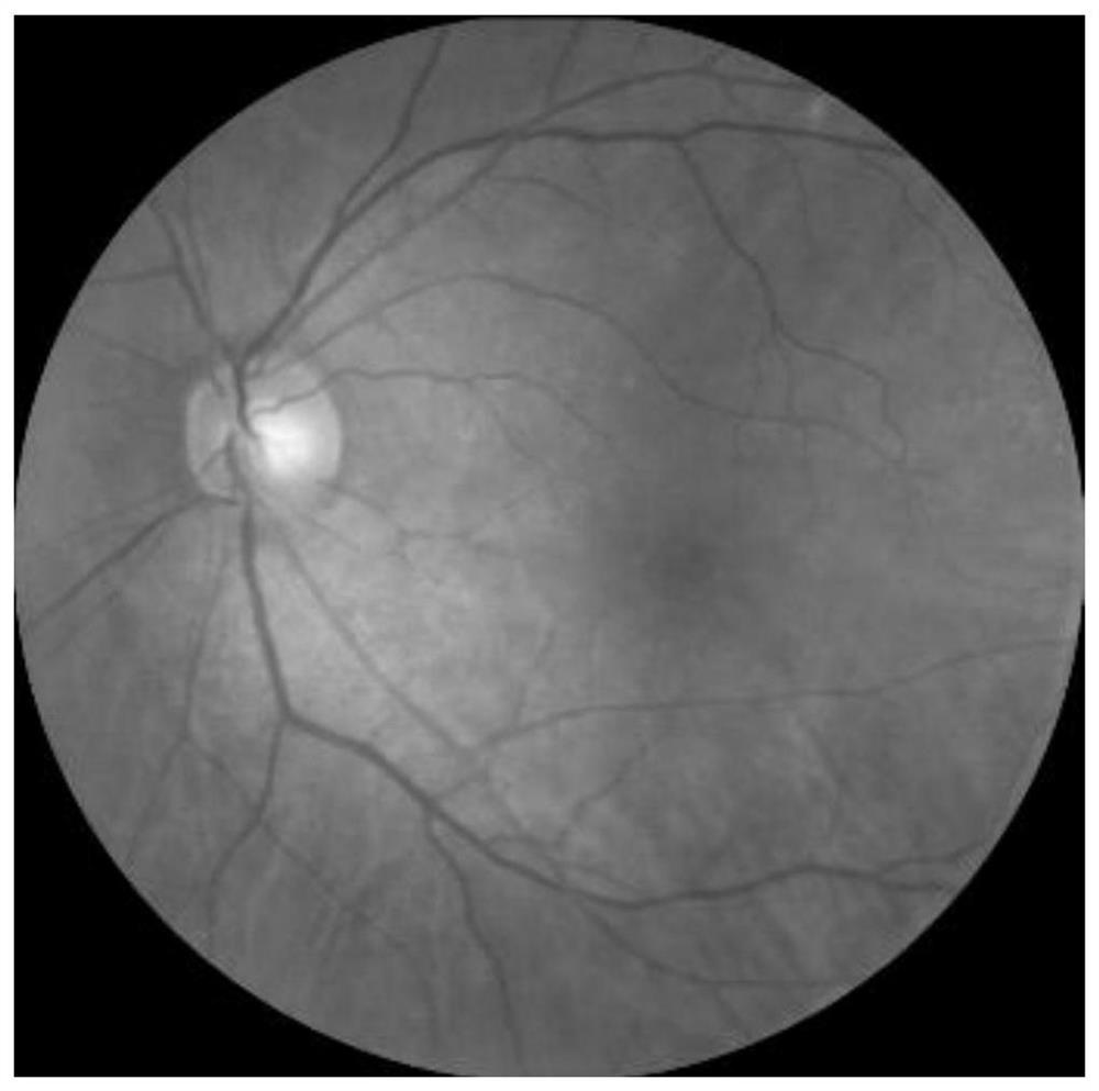 Fundus image recognition model training method, fundus image recognition method and device