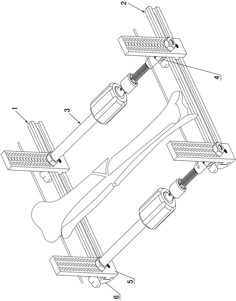 Long bone fracture repositioning device