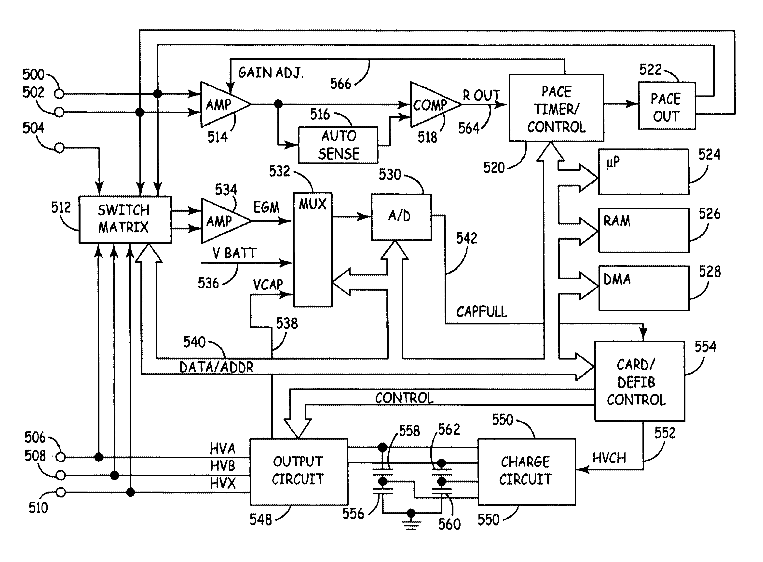 Method and apparatus for detection and treatment of tachycardia and fibrillation