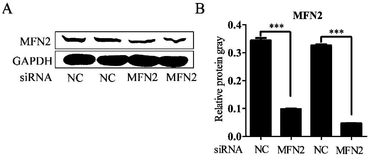 Interference fragment for inhibiting porcine reproductive and respiratory syndrome viruses