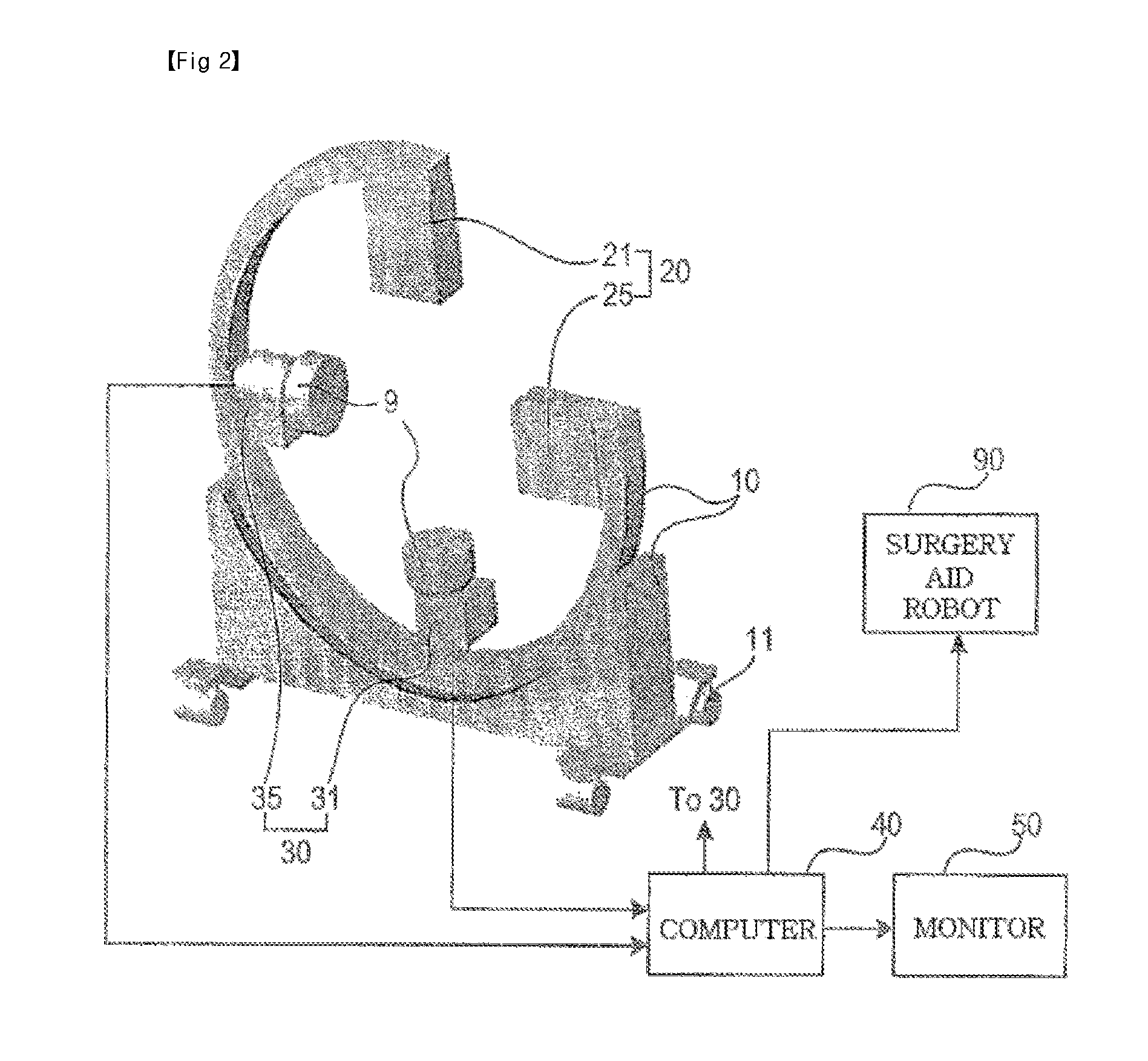 Bi-planar fluoroscopy guided robot system for minimally invasive surgery and the control method thereof