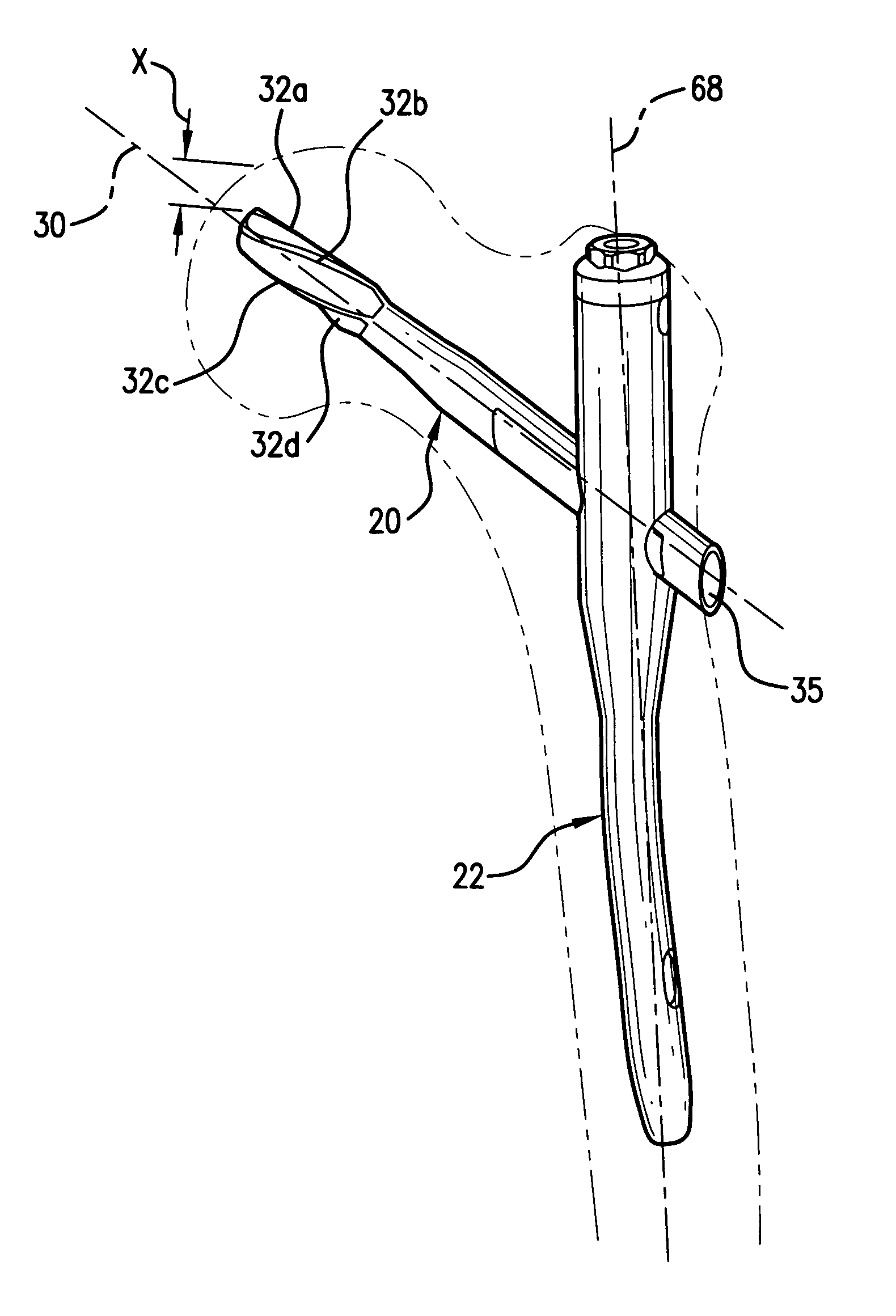 Bone fixation system