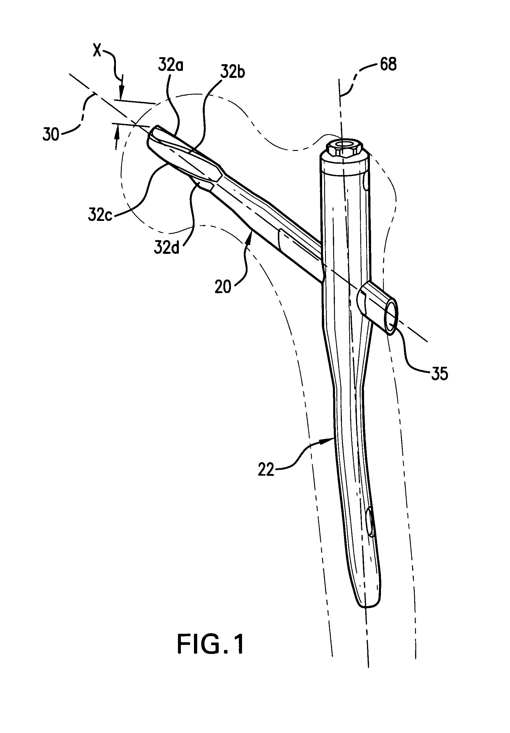 Bone fixation system