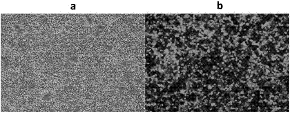 Enhanced type anti-tumor NK cell and preparation method and application thereof