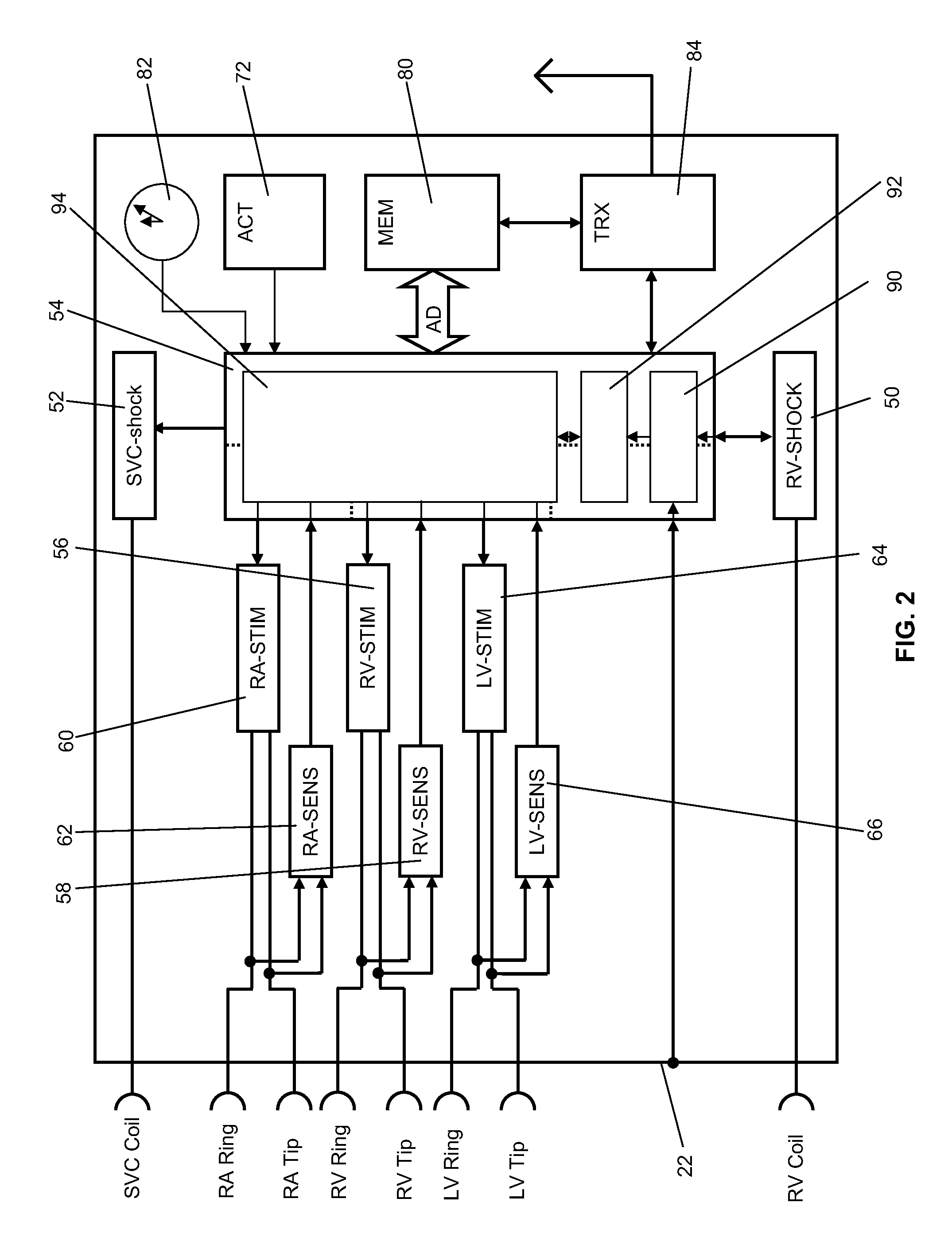 Cardiac stimulator with stimulation success monitoring