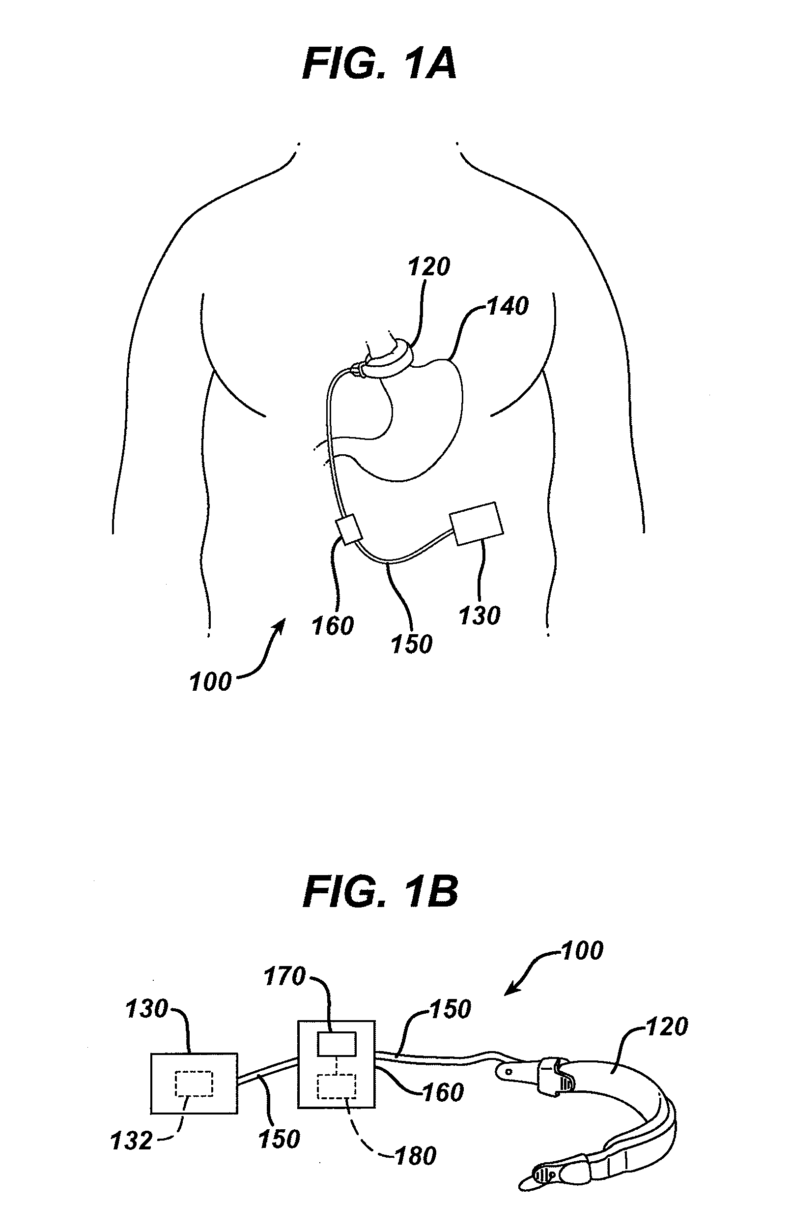 Controlling pressure in adjustable restriction devices