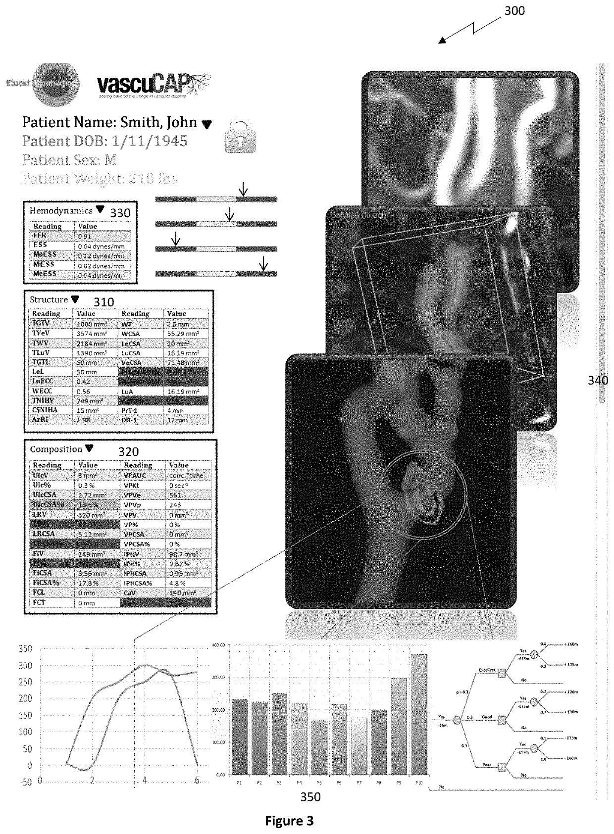 Quantitative imaging for determining time to adverse event (TTE)