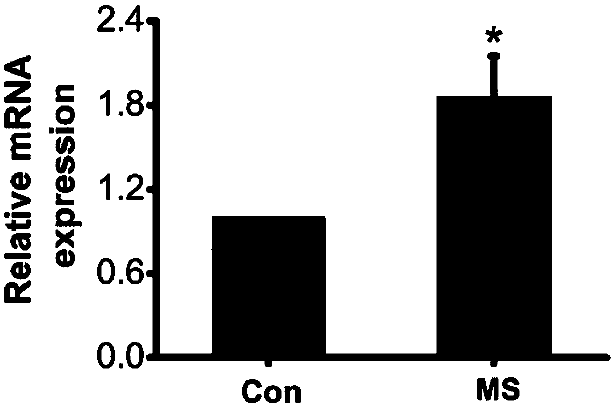 Compound for treating vascular malformation