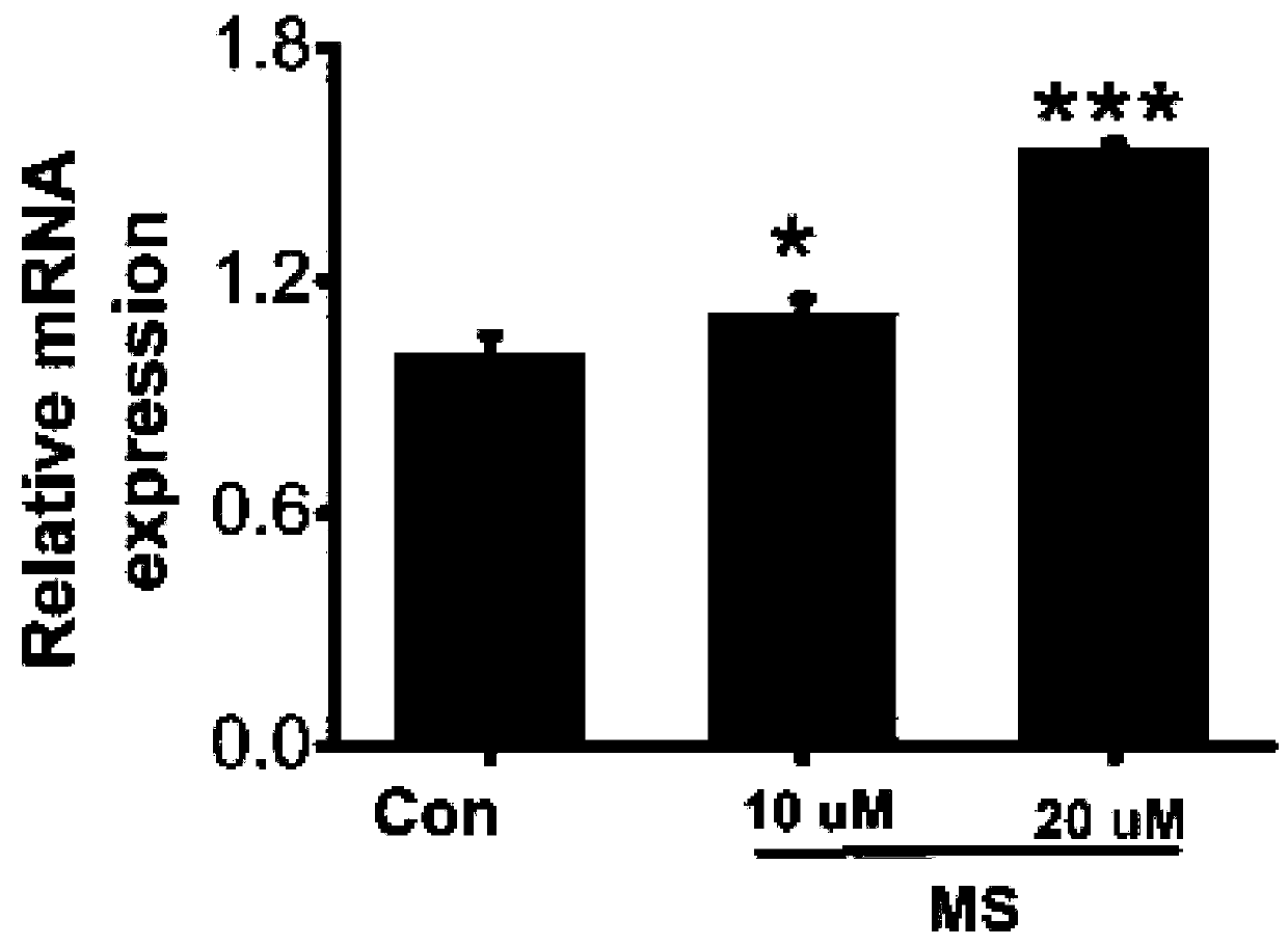 Compound for treating vascular malformation