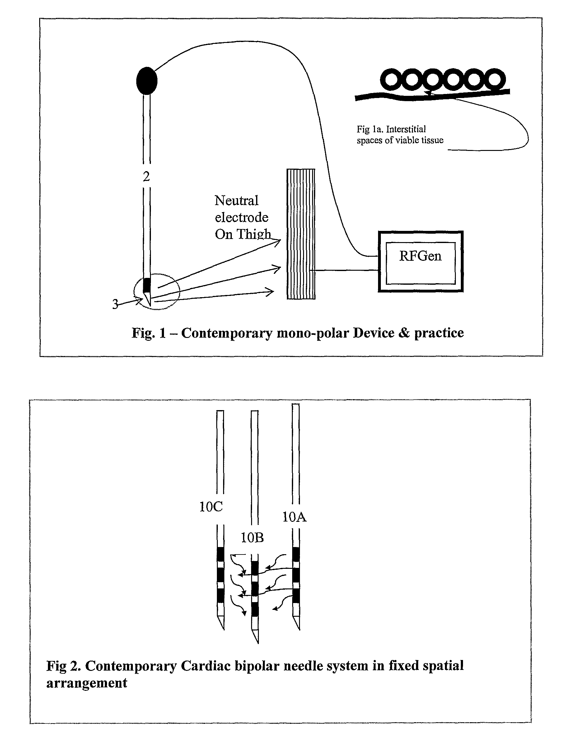 Minimal Device and Method for Effecting Hyperthermia Derived Anesthesia