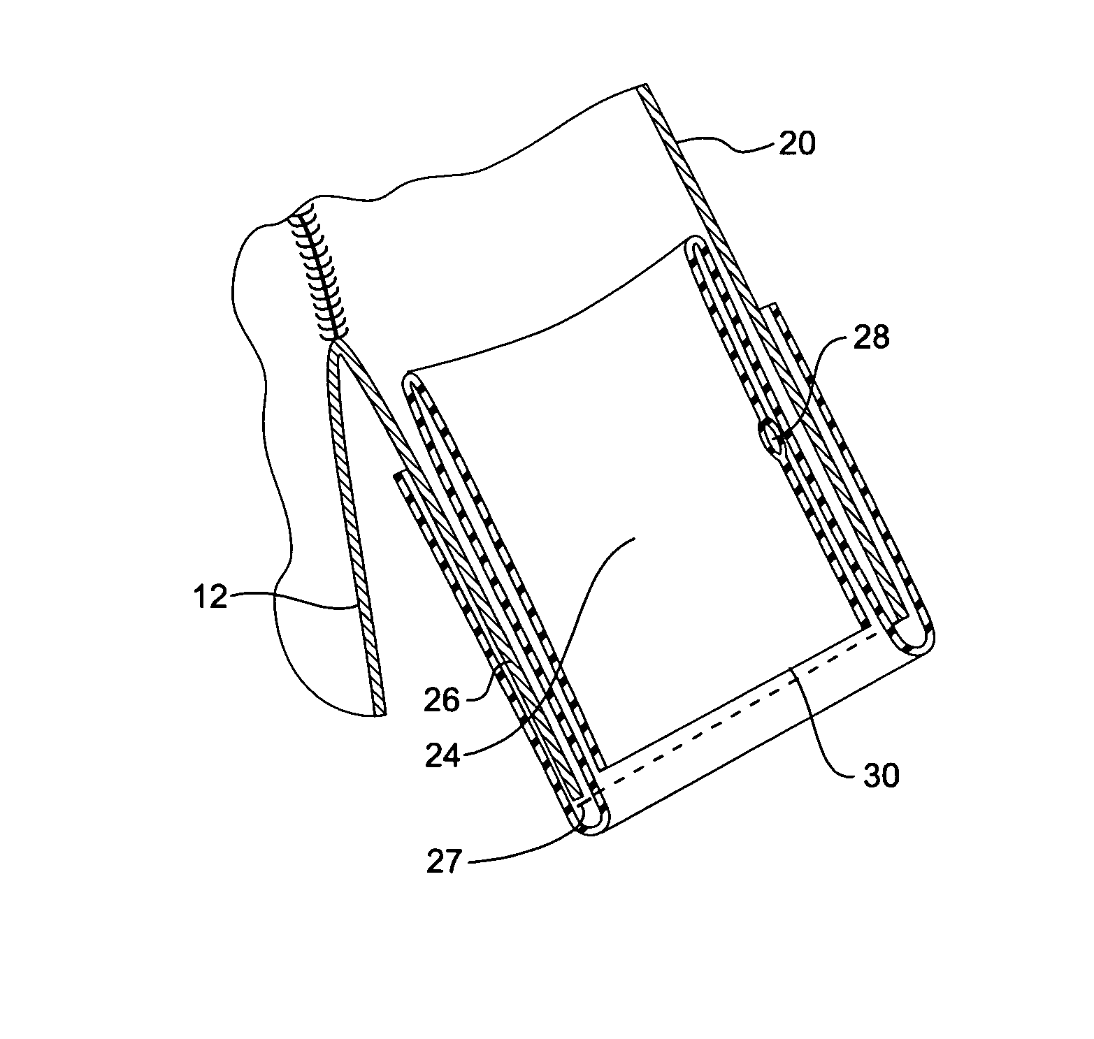 Branch vessel stent graft