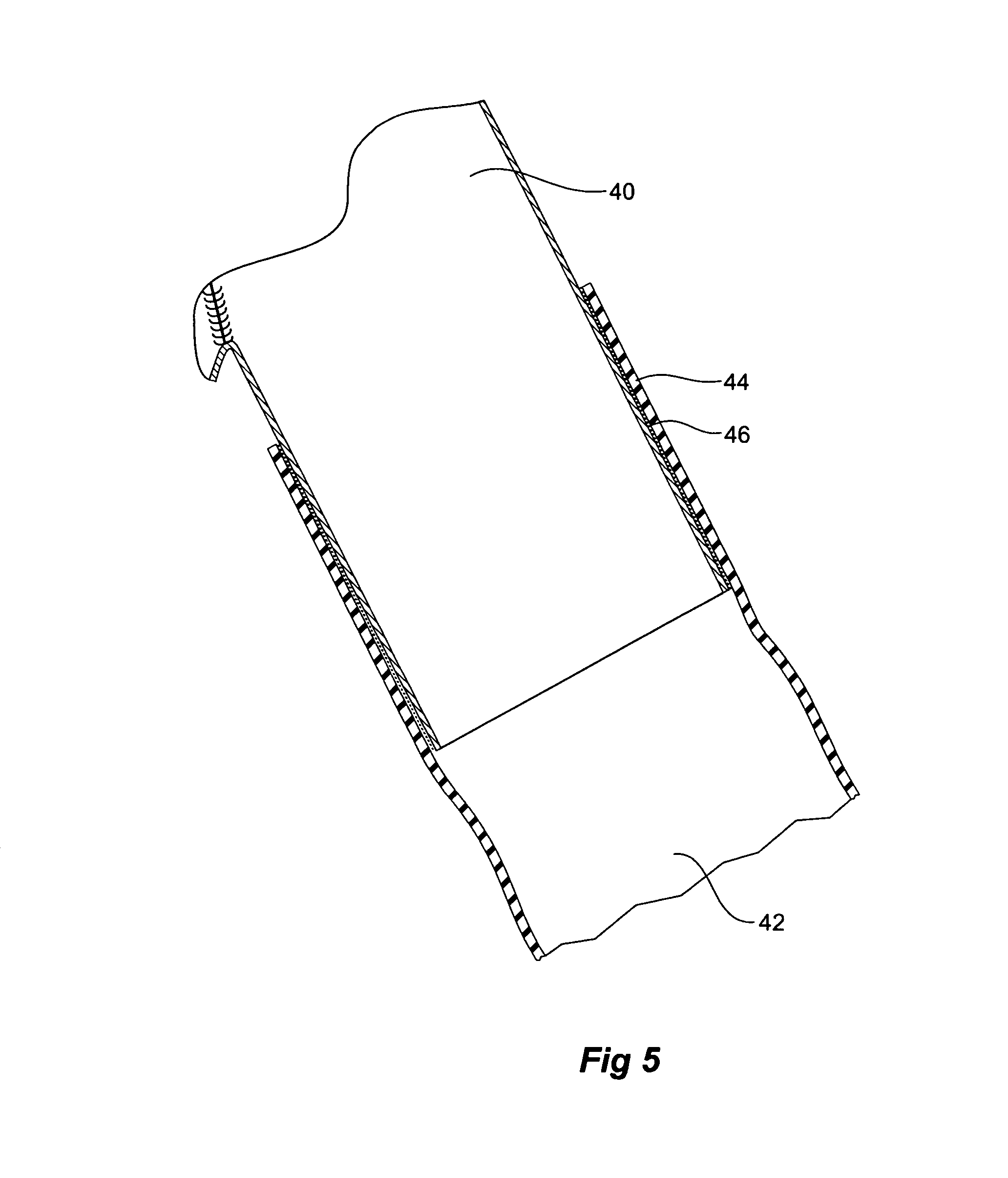 Branch vessel stent graft