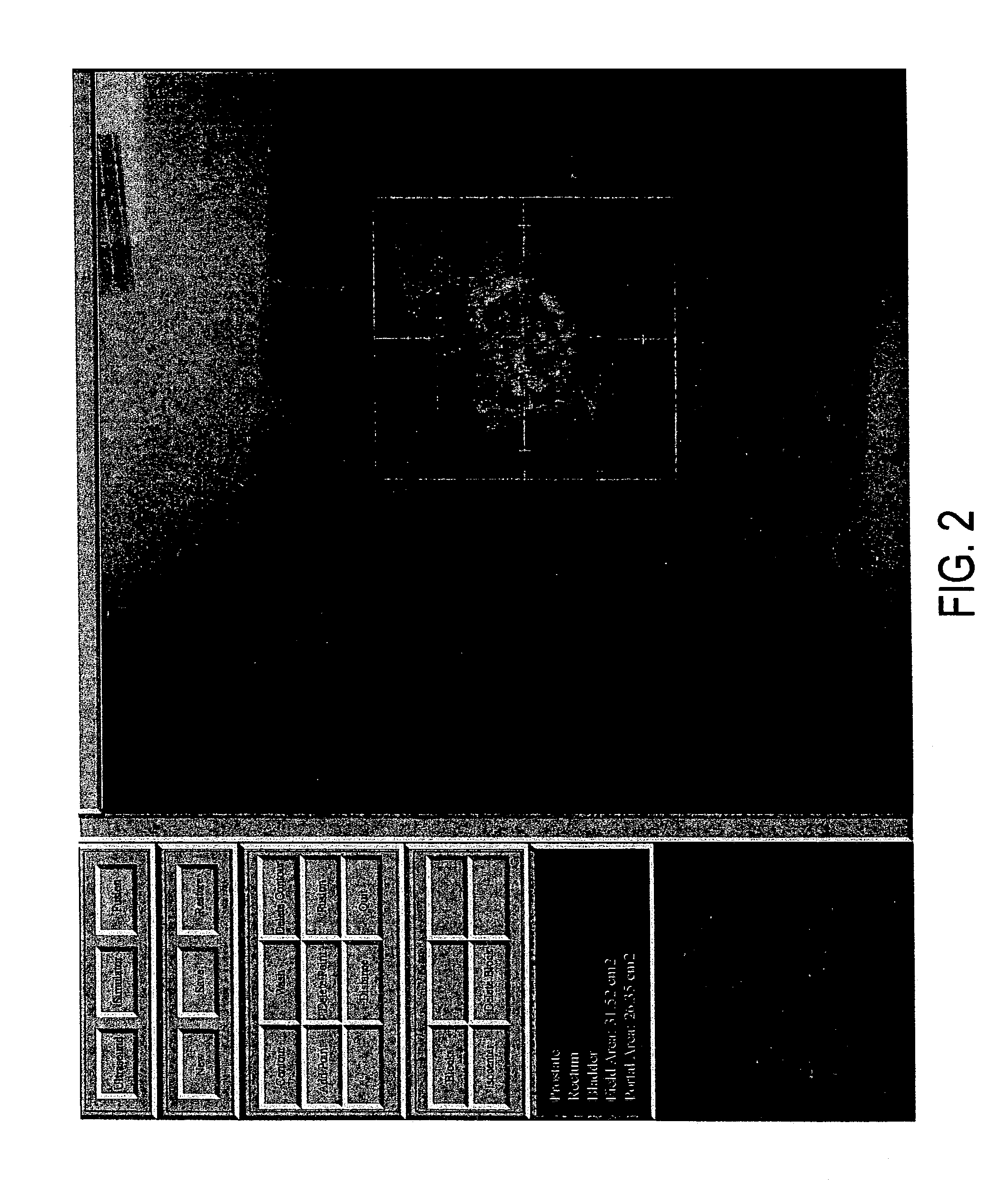 Apparatus and method for registration, guidance and targeting of external beam radiation therapy