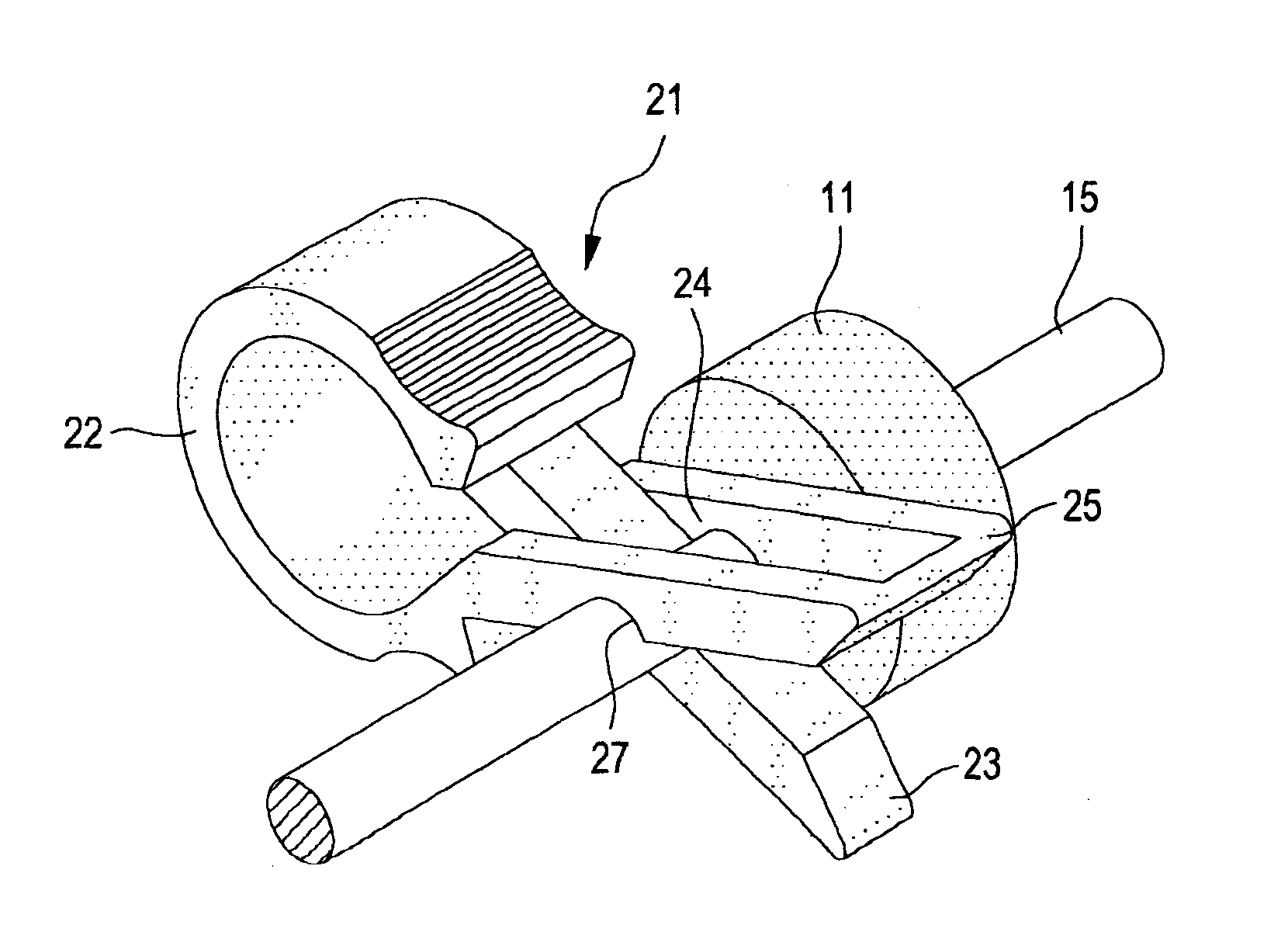 Pin site wound protection system