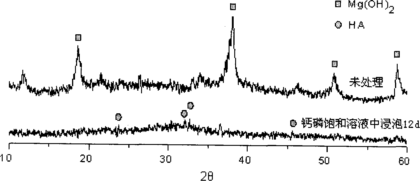 Bionics method preparation of pure magnesium surface agustite coating