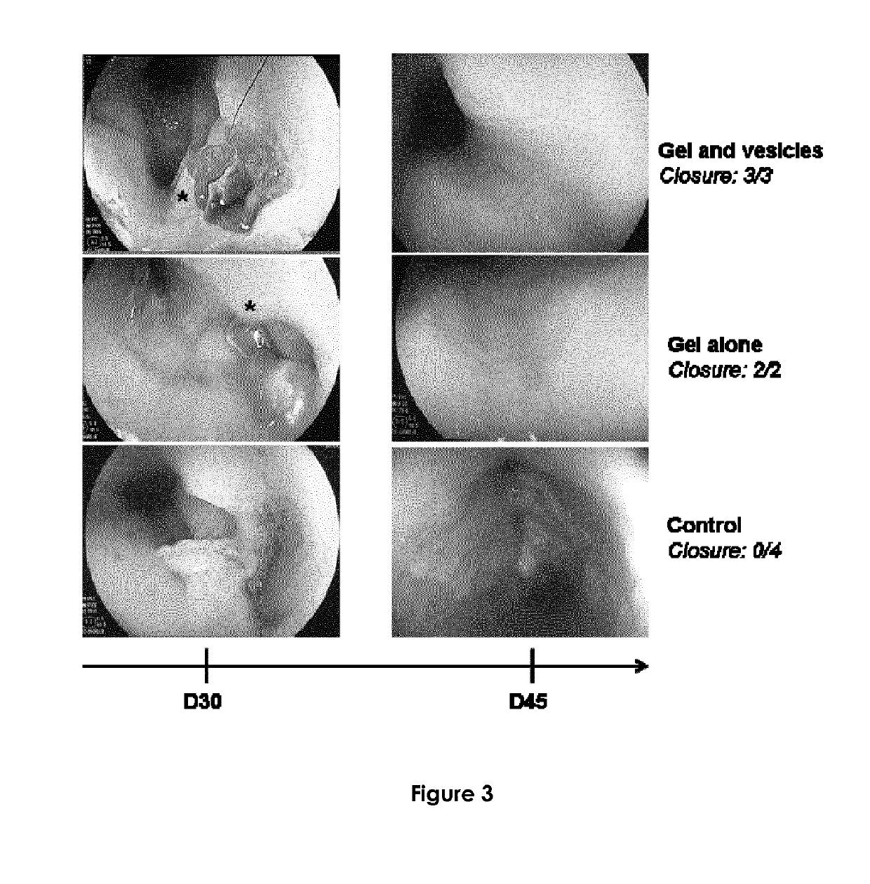 Compositions useful for mucosal healing