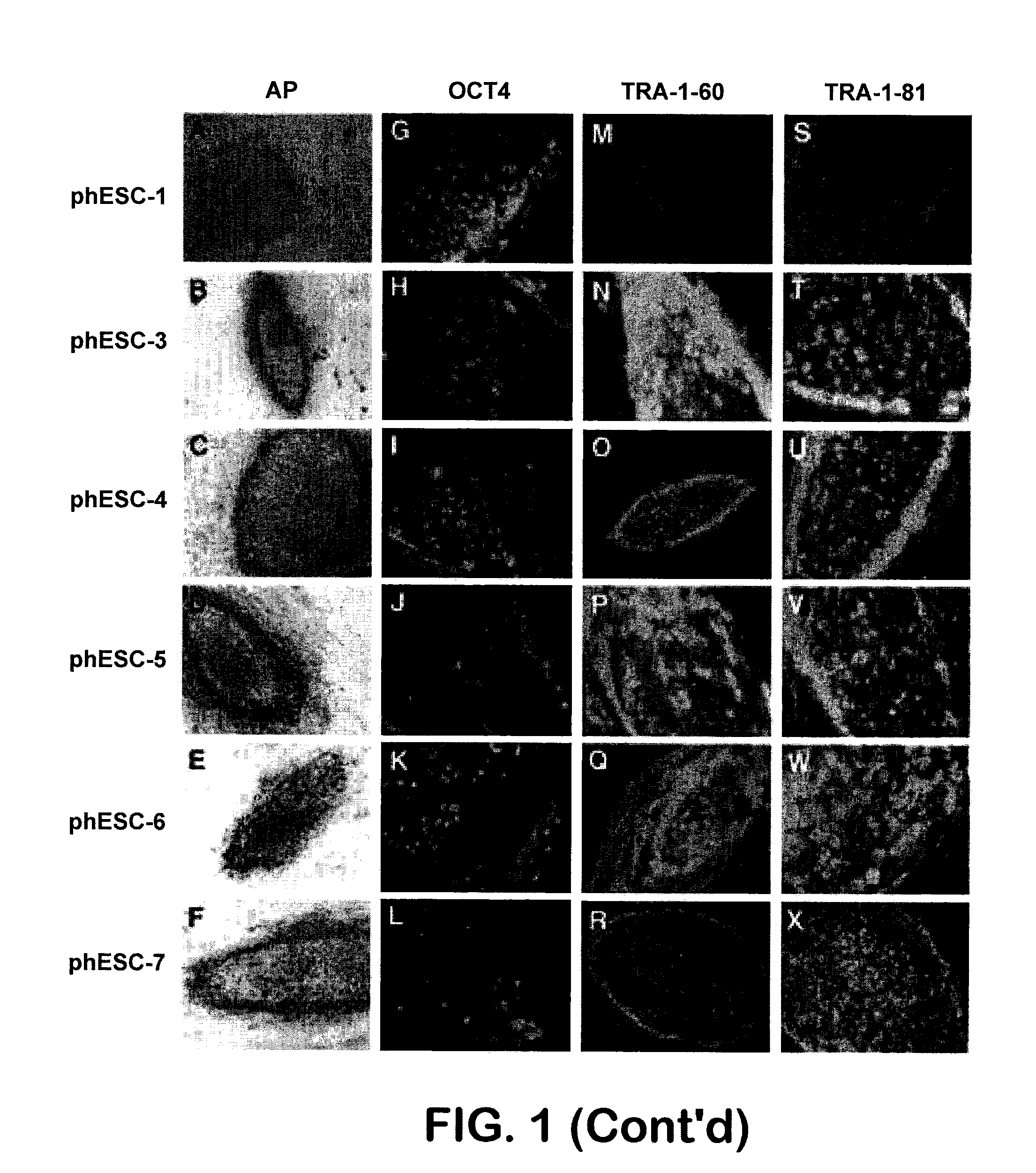 Patient-specific stem cell lines derived from human parthenogenetic blastocysts