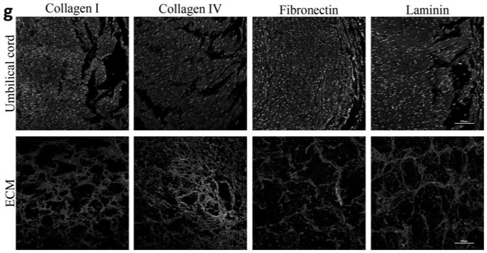 Acellular matrix hydrogel as well as preparation method and application thereof