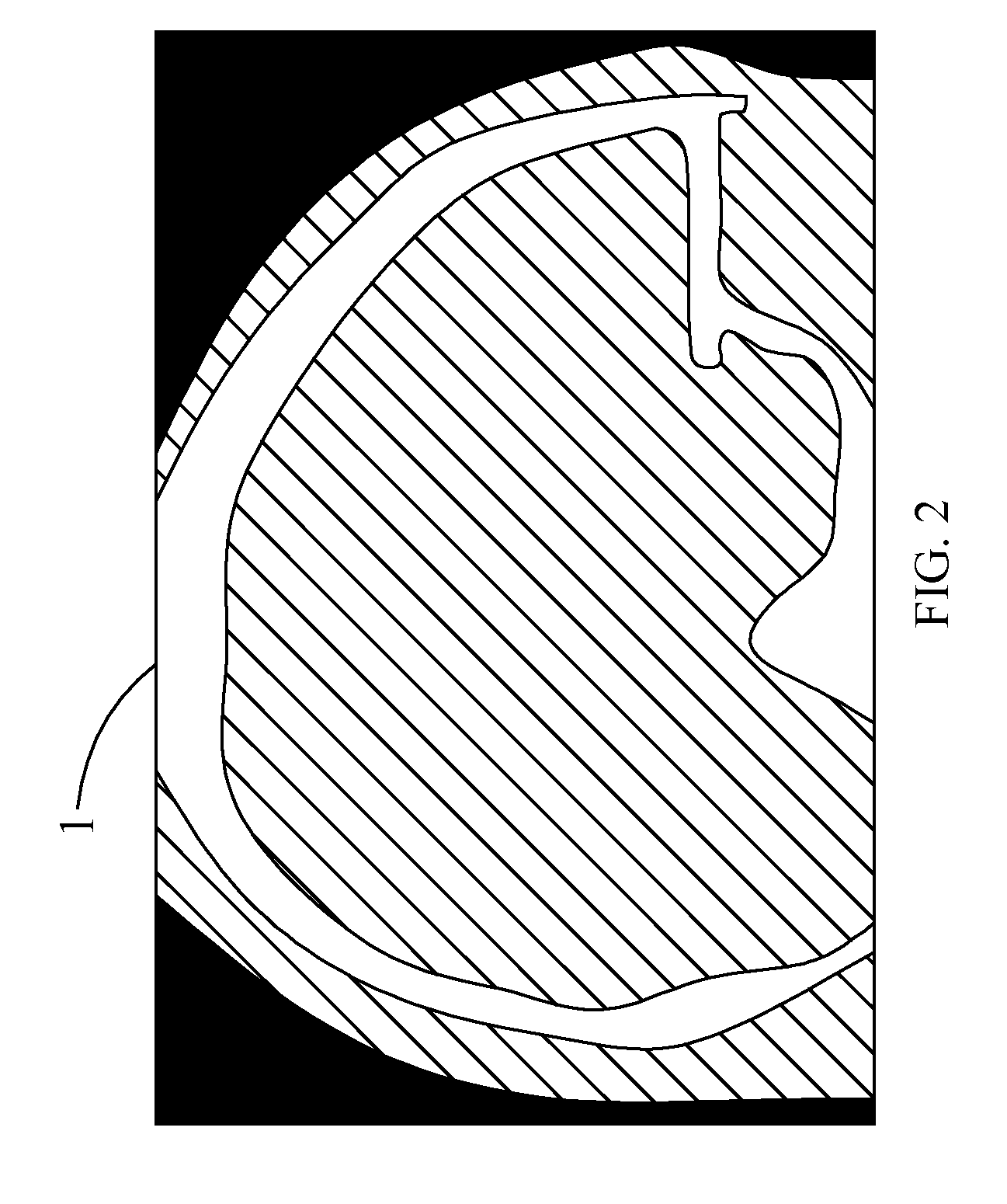 Method for manufacturing artificial implants