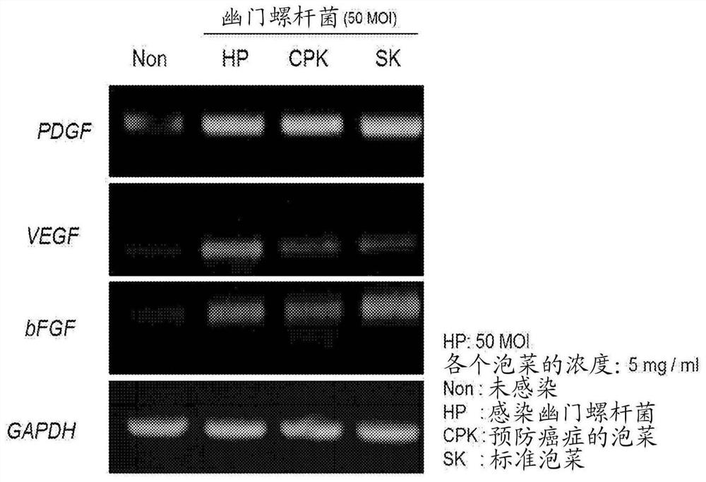 Kimchi for preventing or treating helicobacter pylori-associated diseases