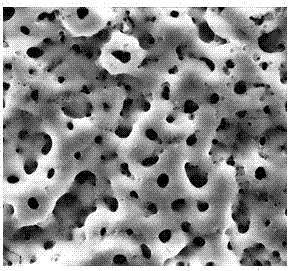 Bioactive coating of metal implant and preparation method thereof