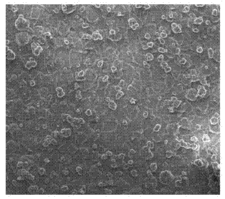 Bioactive coating of metal implant and preparation method thereof