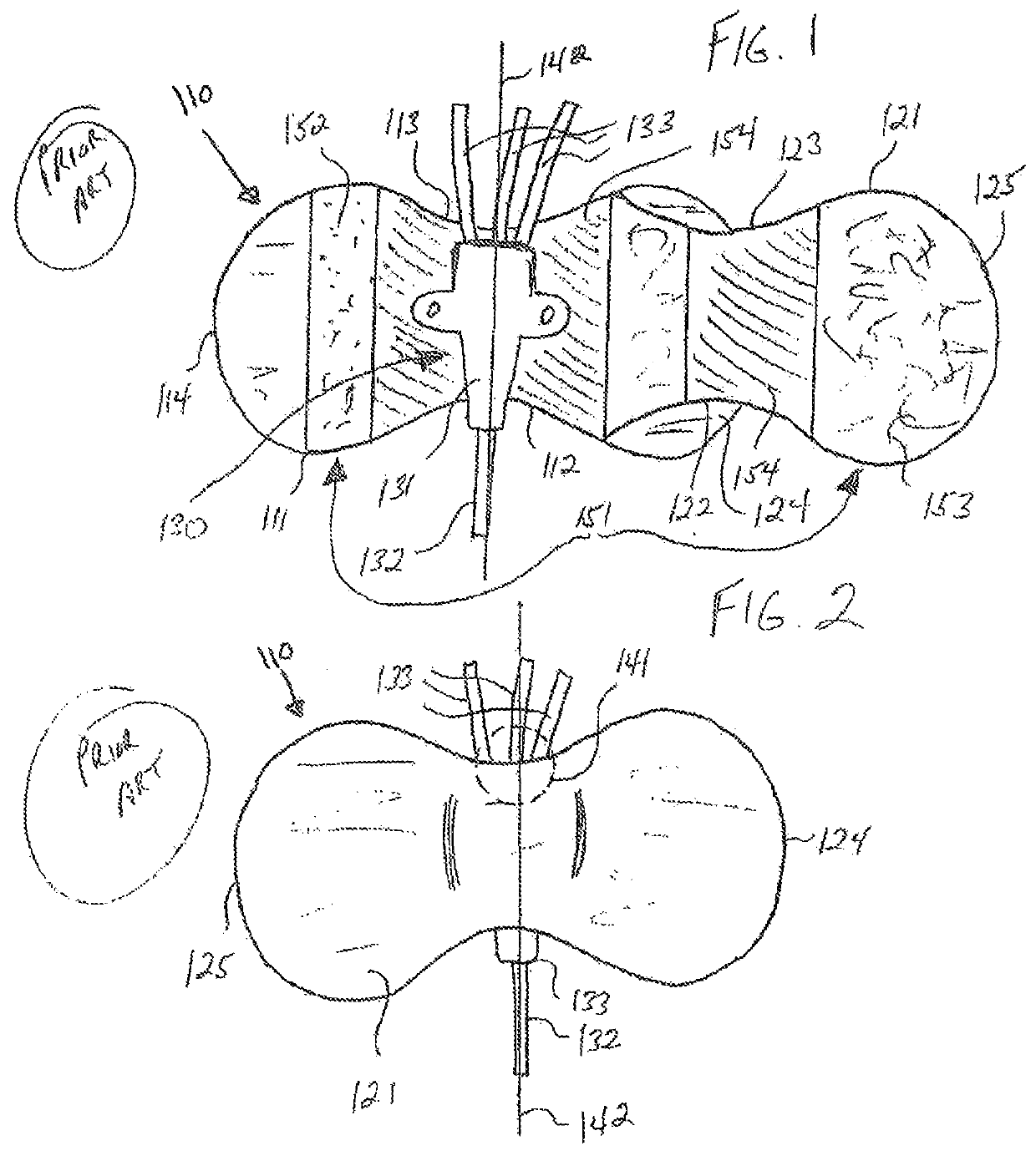 Offset catheter securement device