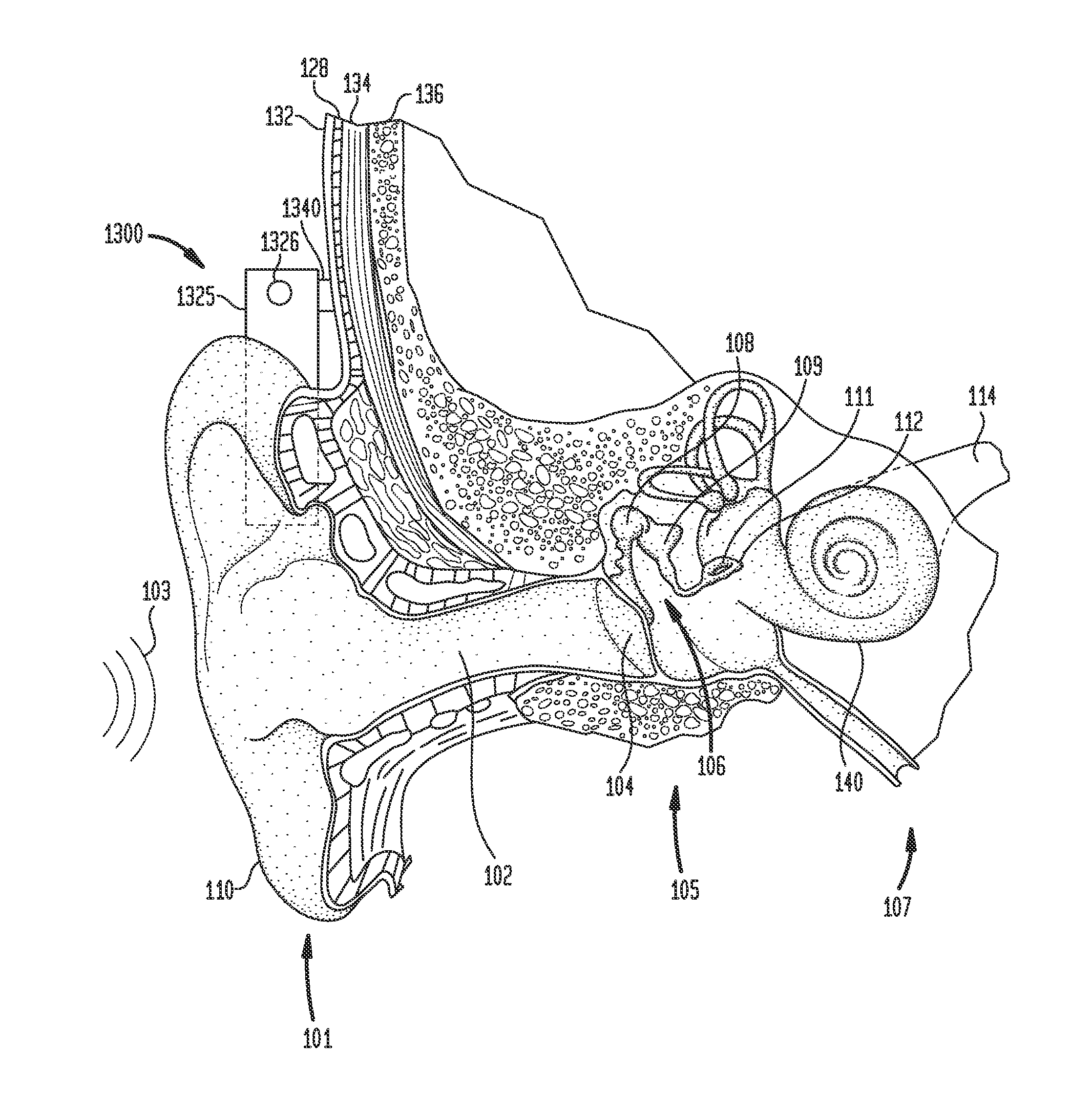 Assessing auditory prosthesis actuator performance