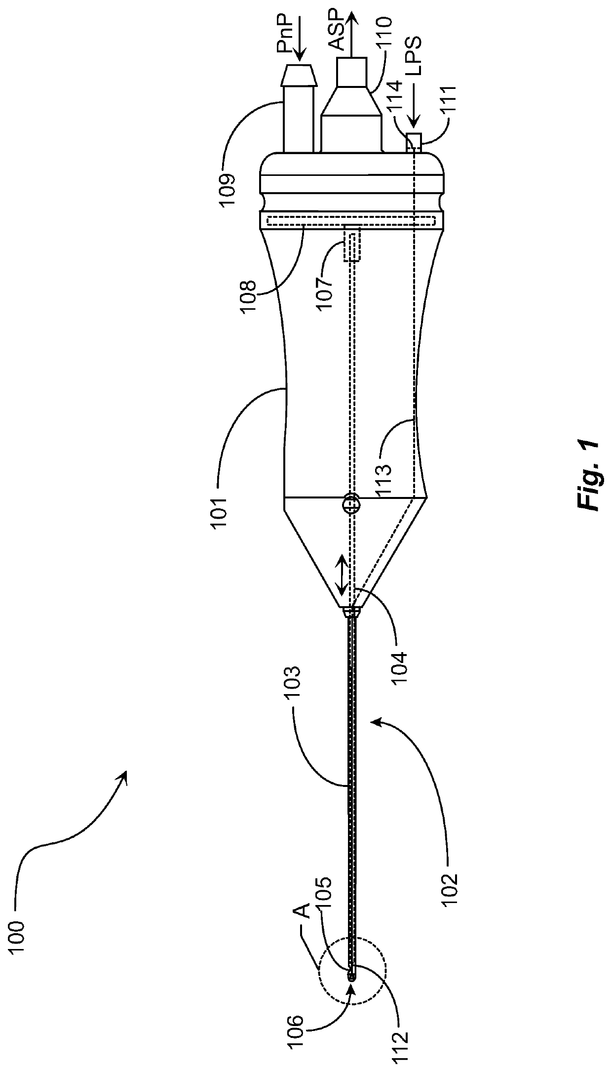 Vitrector Cutting Device with Distal Illumination Module