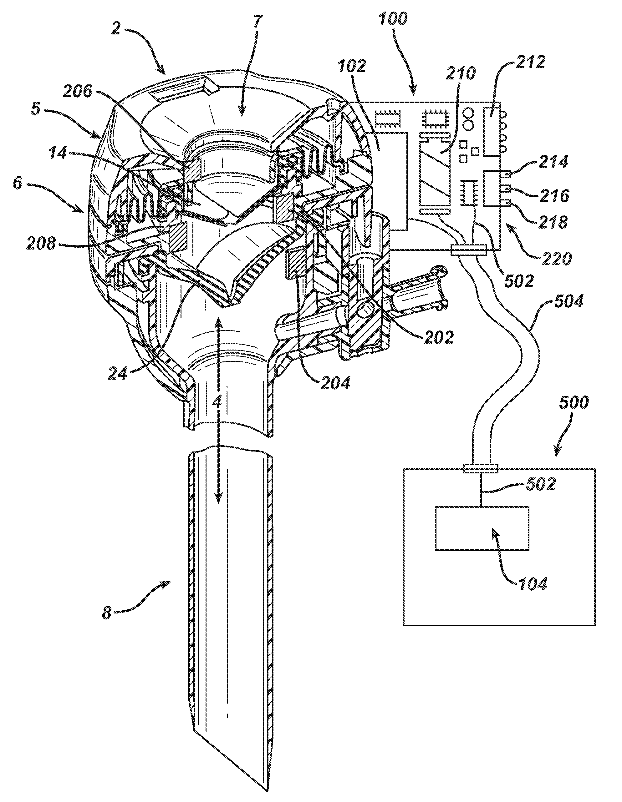 Vibratory trocar