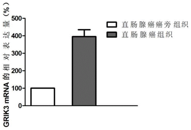 Molecular marker GRIK3 of rectal gland cancer