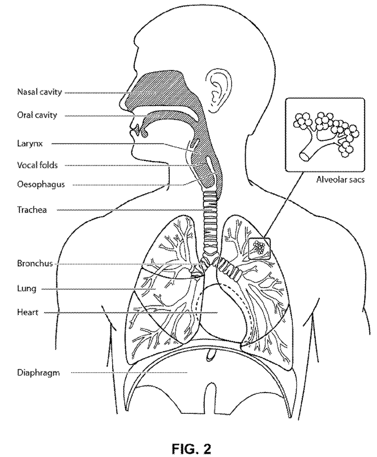 Systems and methods for screening, diagnosis and monitoring sleep-disordered breathing