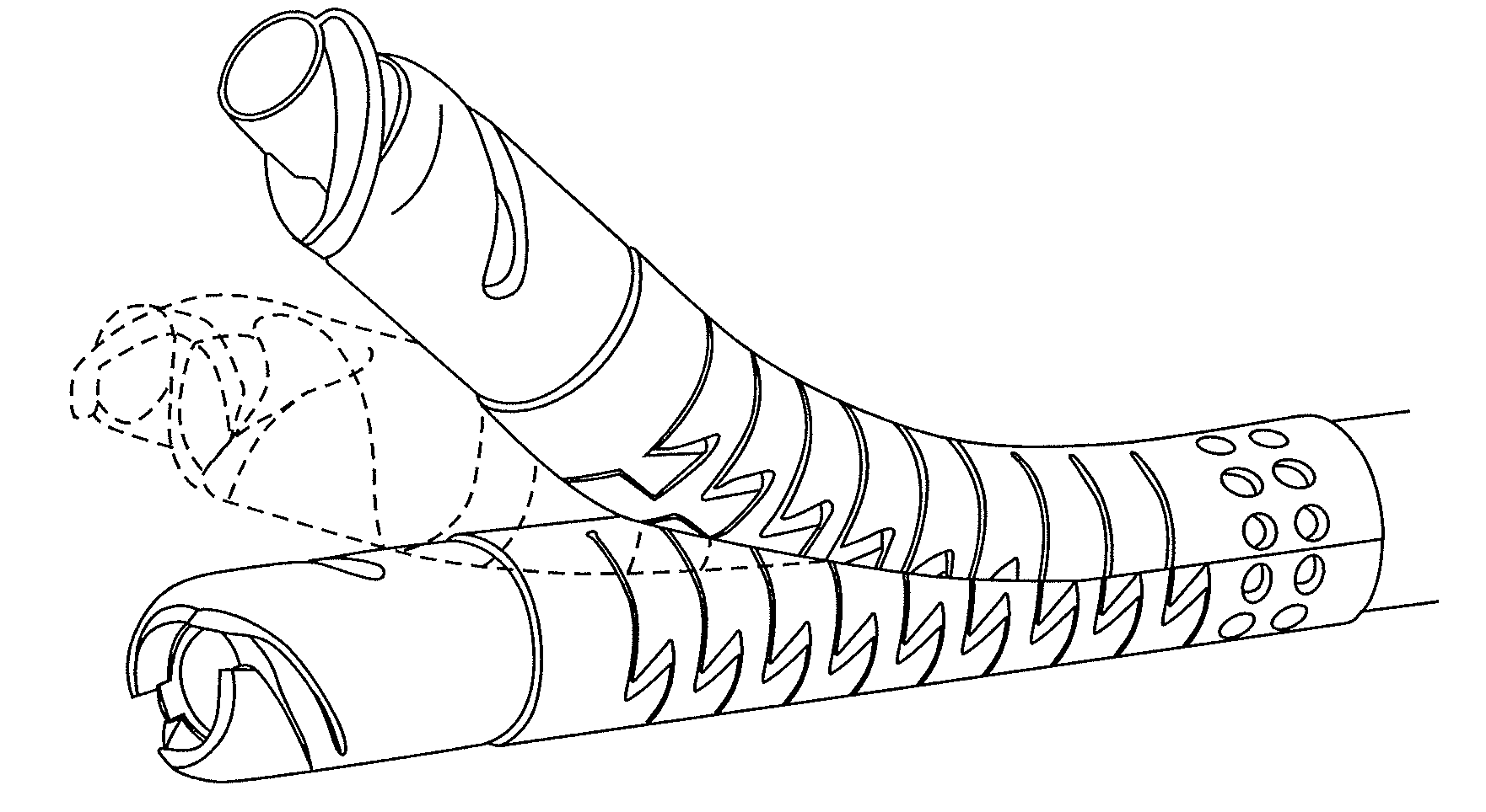 Guidewire positioning catheter