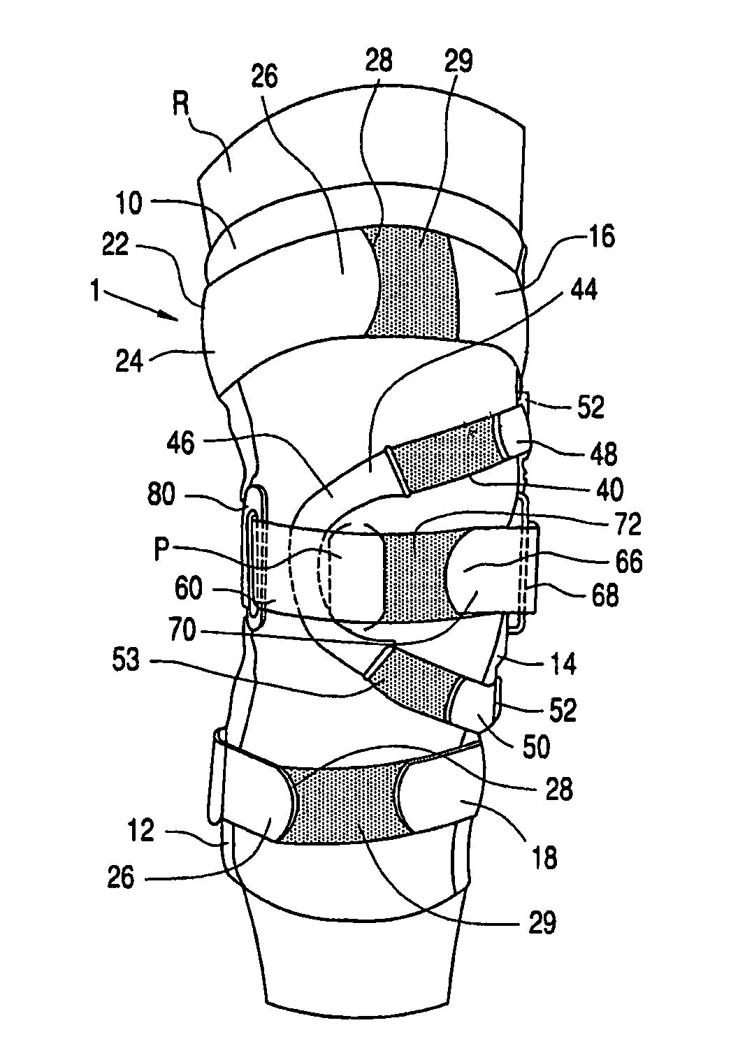 Knee orthosis and orthotic method