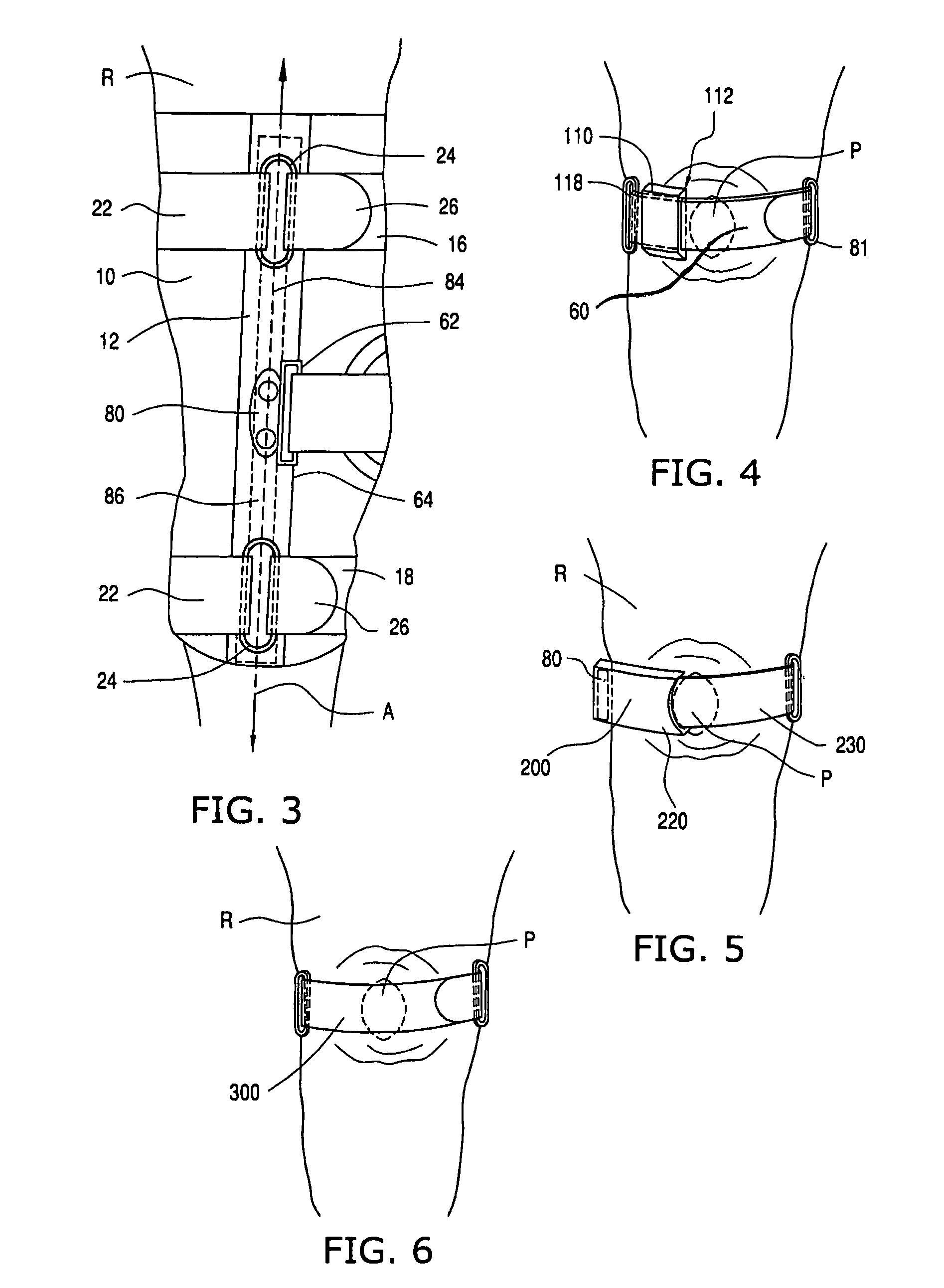 Knee orthosis and orthotic method