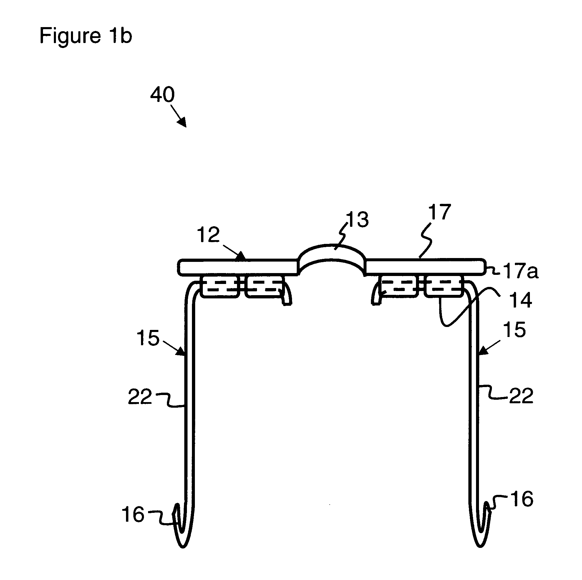 Precision irrigator apparatus, system and method