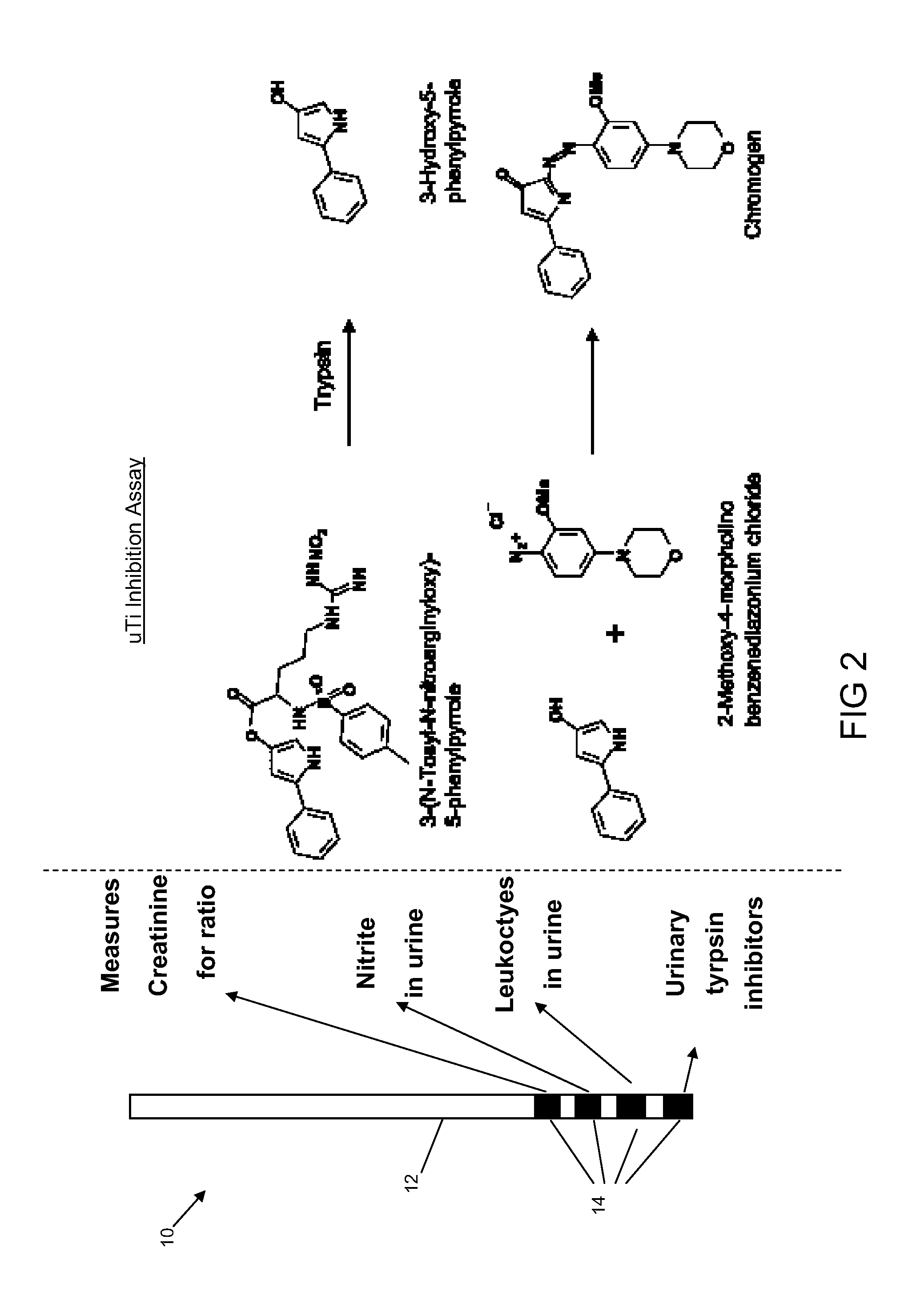 Urinary trypsin inhibitors as diagnostic aid for interstitial cystitis