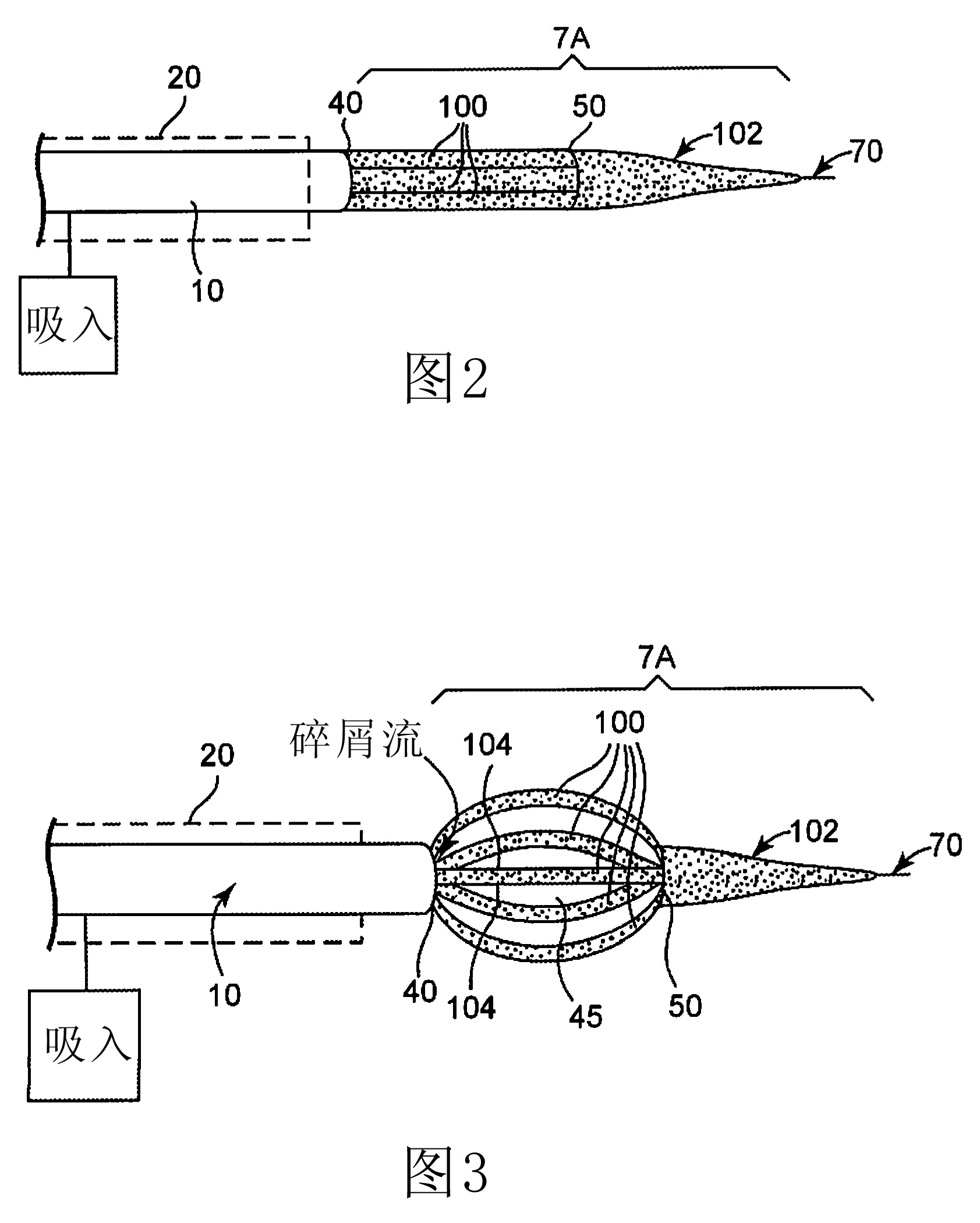 Abrasive nose cone with expandable cutting and sanding region for rotational atherectomy device