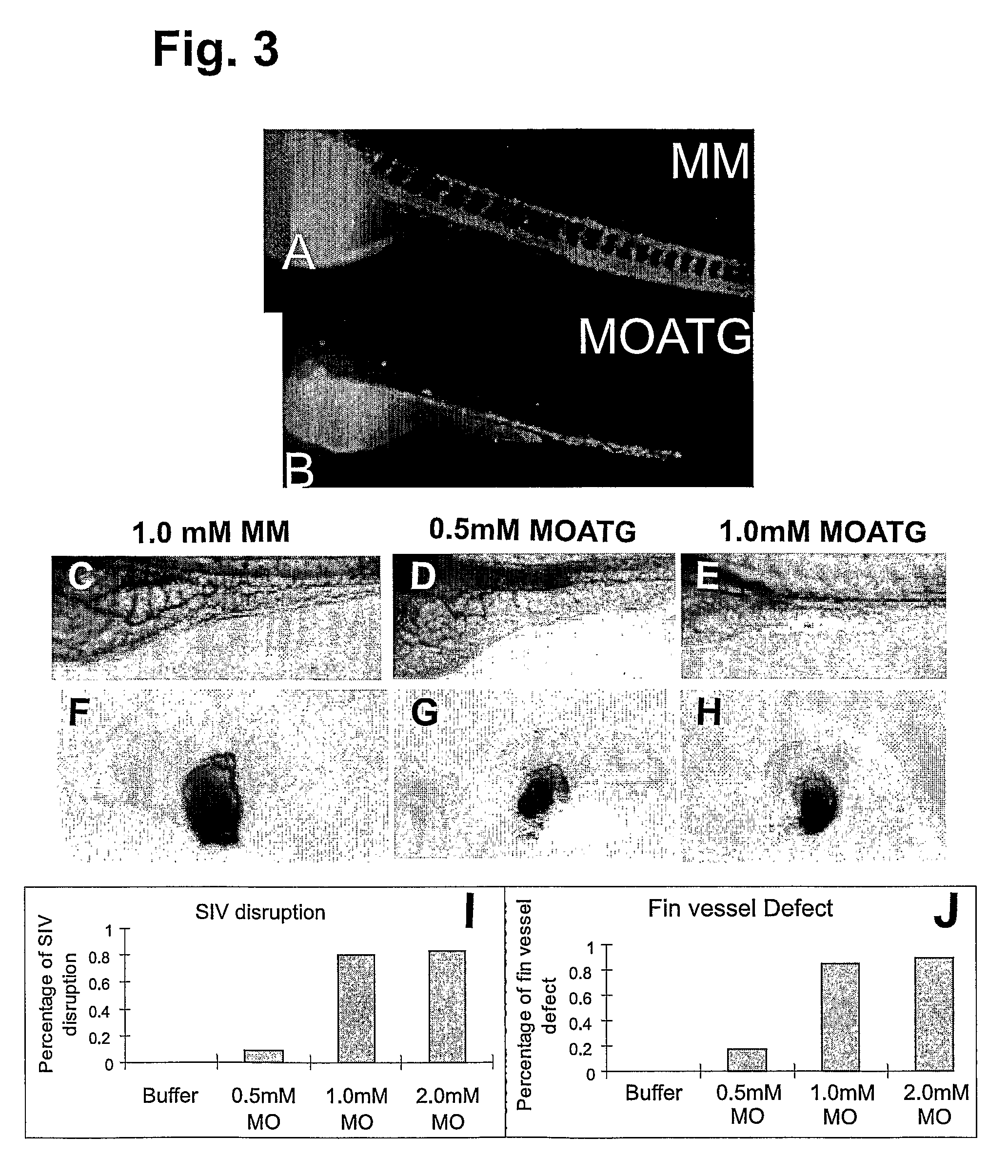 Methods and compositions for the treatment and diagnosis of endothelial cell disorders and angiogenic disorders