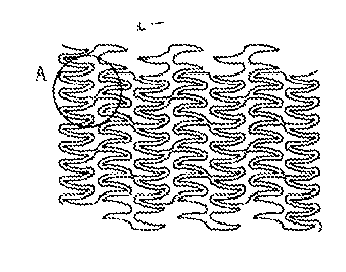 Methods and apparatus for stenting comprising enhanced embolic protection coupled with improved protections against restenosis and thrombus formation