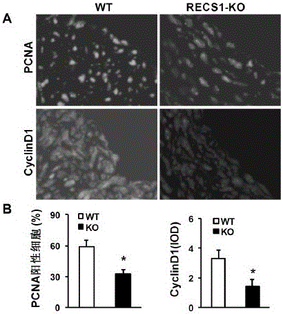 Function and application of centrifugal force and shear stress response gene 1 (recs1) in the treatment of restenosis after vascular injury