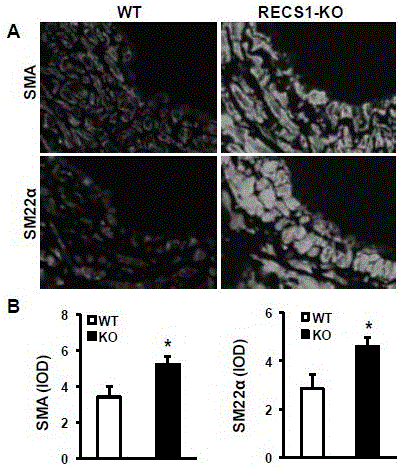 Function and application of centrifugal force and shear stress response gene 1 (recs1) in the treatment of restenosis after vascular injury