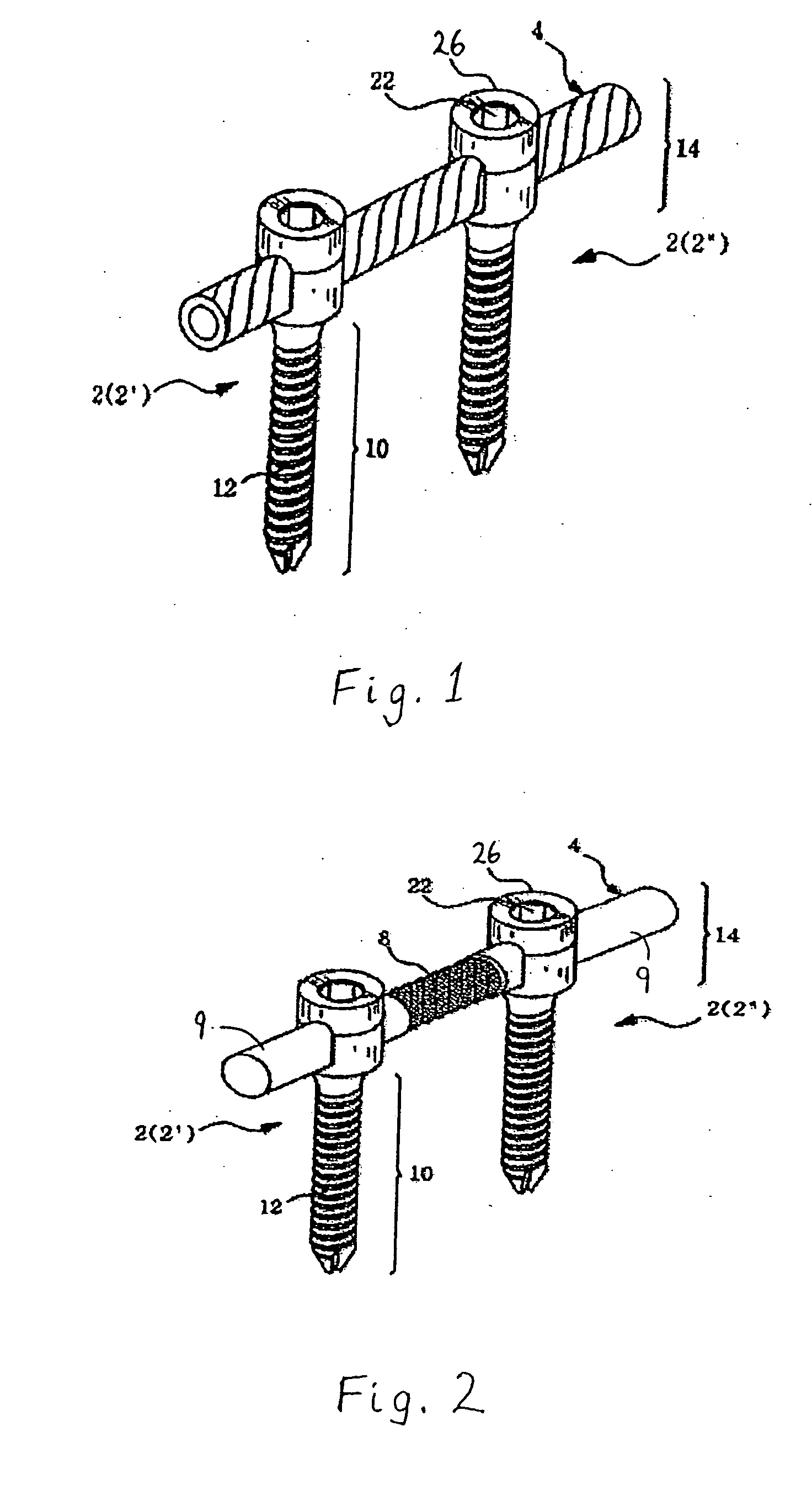 Spinal stabilization device