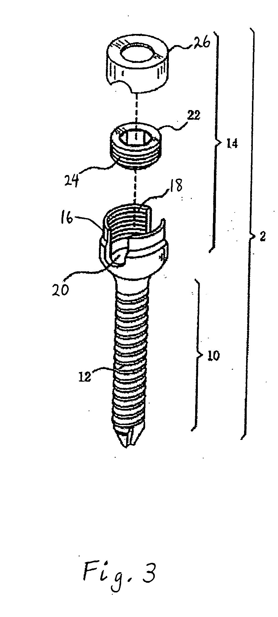 Spinal stabilization device