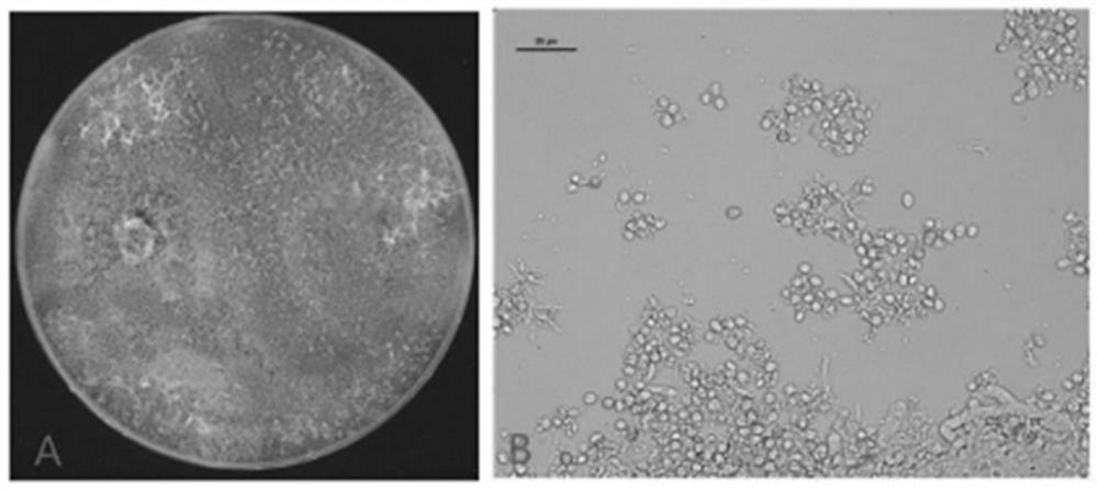 Trichoderma asperellum and application thereof