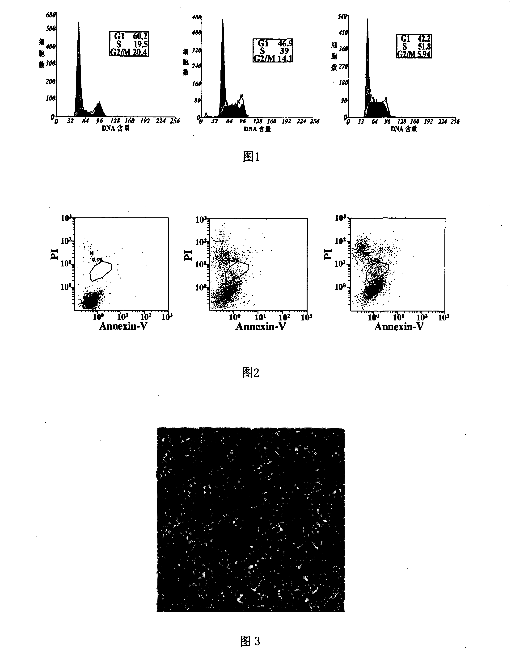 Application of PDCD4 regroup expression vector on process for preparing medicine curing glioma