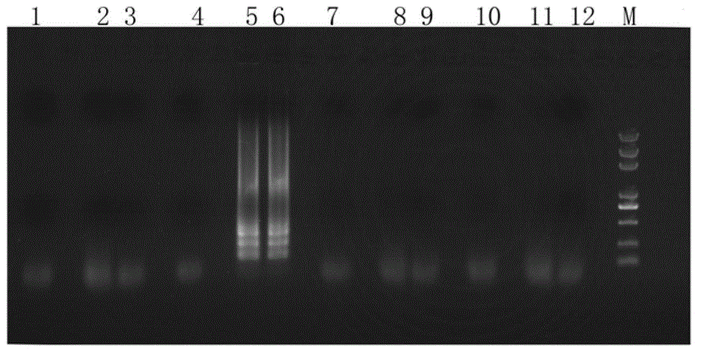 One-step loop-mediated reverse transcription isothermal amplification detection method for soybean mosaic virus